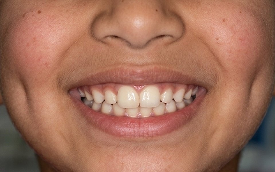 When Should Your Child First Visit the Dentist? A Parent's Guide