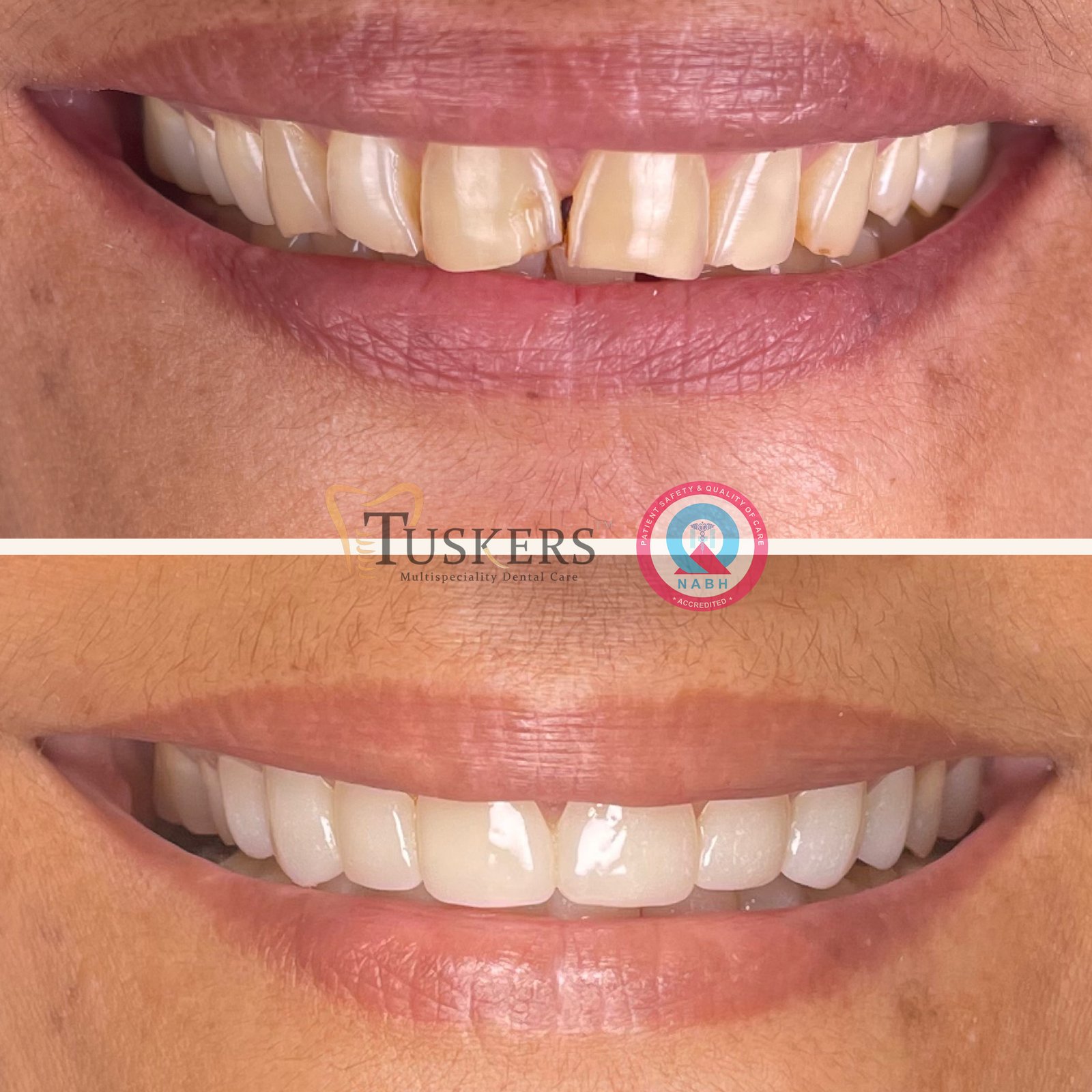 Tuskers Cosmetic Dentistry Suite